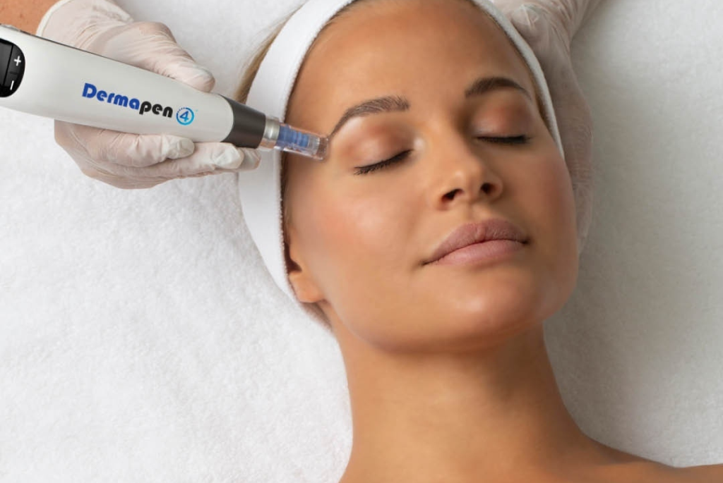 Microneedling with Dermapen 4 | Collagen Boost & Skin Rejuvenation