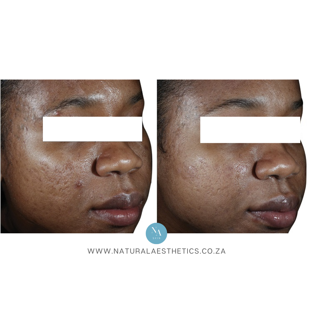 Venus-Viva-Treatments-Cape-Town