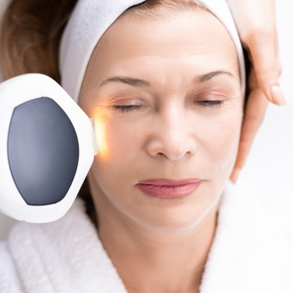 Venus-Versa-IPL-Peel-Treatment