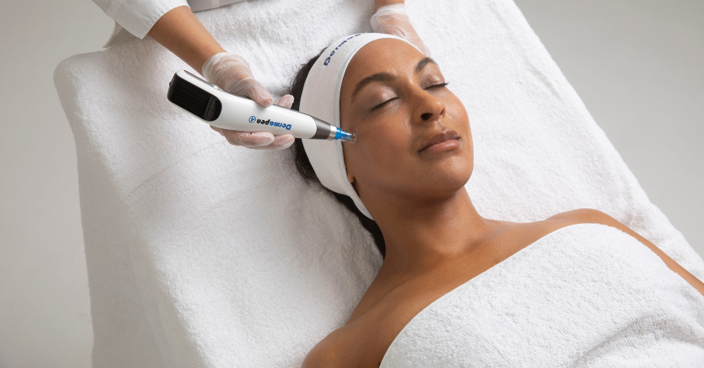 Dermapen 4™ & Double Peel Promo - Natural Aesthetics