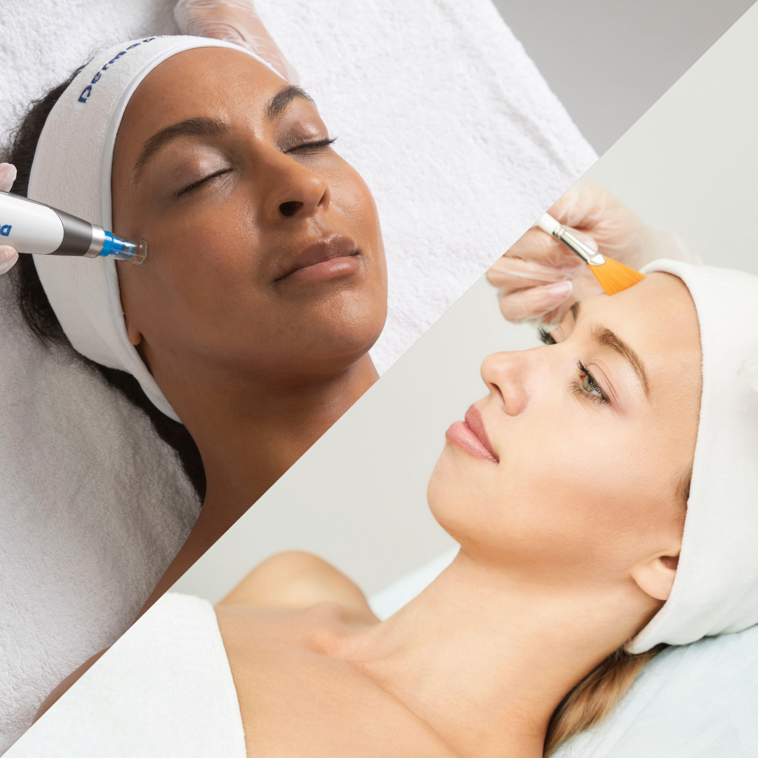 Dermapen 4™ Microneedling & Chemical Peel Packages Cape Town